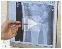 Gelenkdiagnostik